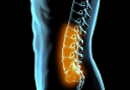 Atlanta Spinal Cord Injury Lawyers